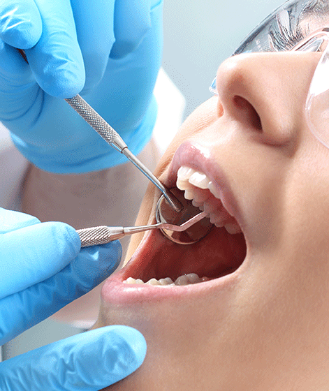  Aftercare Tips for Root Canal Patients in Dubai