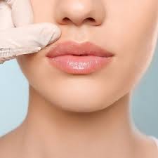 Plump Up Your Pout: Top-Rated Lip Fillers in Dubai