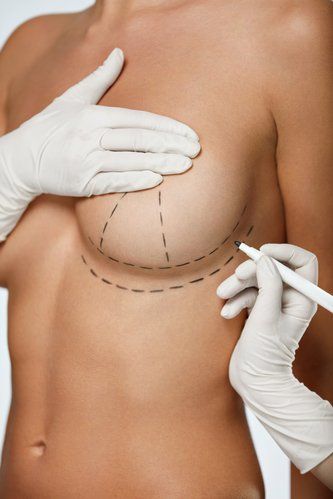 What Is the Recovery Time for Breast Augmentation in Dubai?