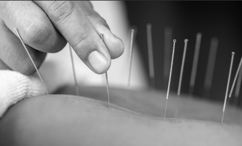  Pain Management Acupuncture: Chinese Acupuncture in Bayside, Melbourne